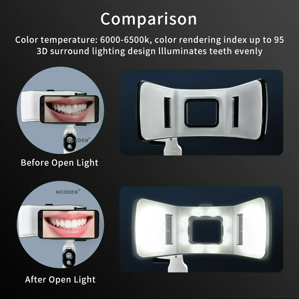 Dental Photography Light Phone - Photography Lighting Accessories review and price