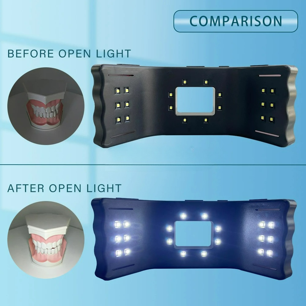 Dental Photography Light Phone - Photography Lighting Accessories review and price